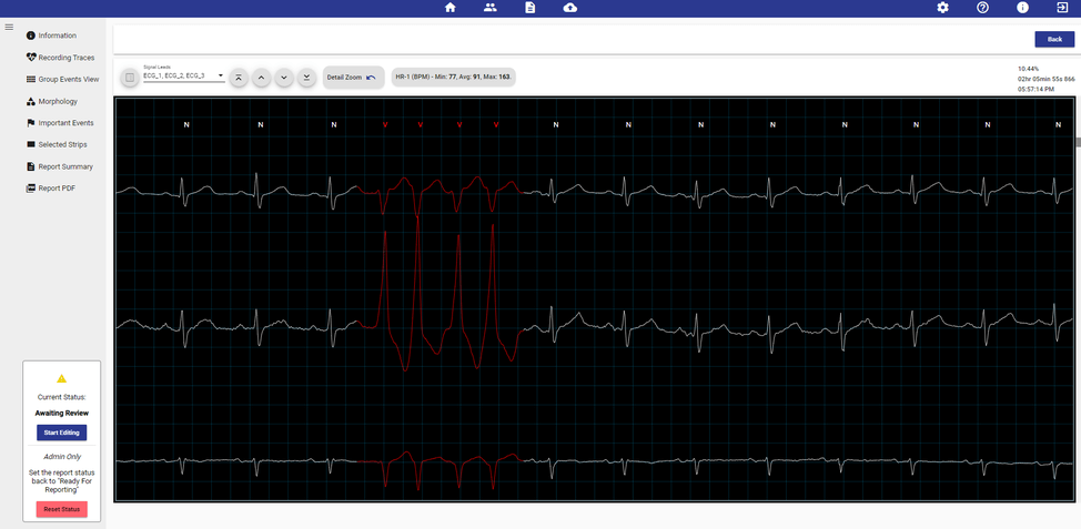 holter-details