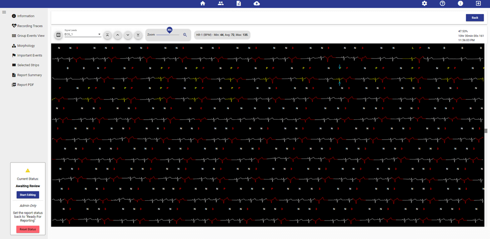 holter-scan-img